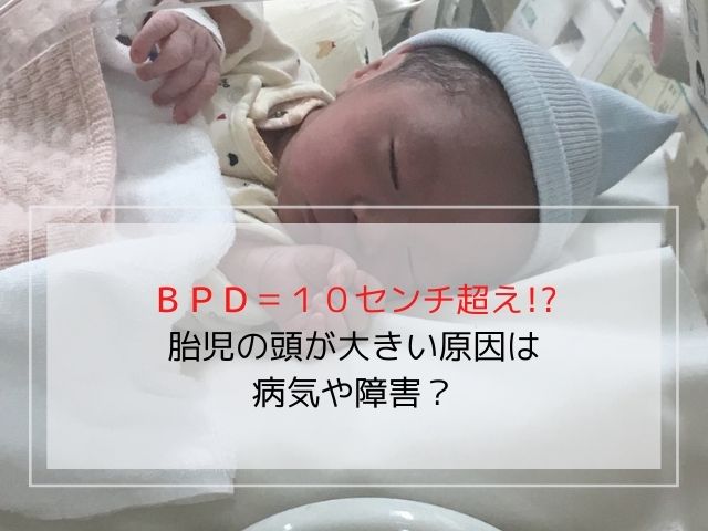 出産レポ Bpd 10センチ超え 胎児の頭が大きい原因は病気や障害 ママぽちっ