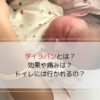 「ダイラパンとは？」の記事のアイキャッチ画像です。