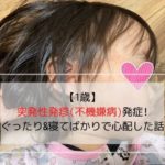 1歳児が突発性発疹にかかった時の写真です。